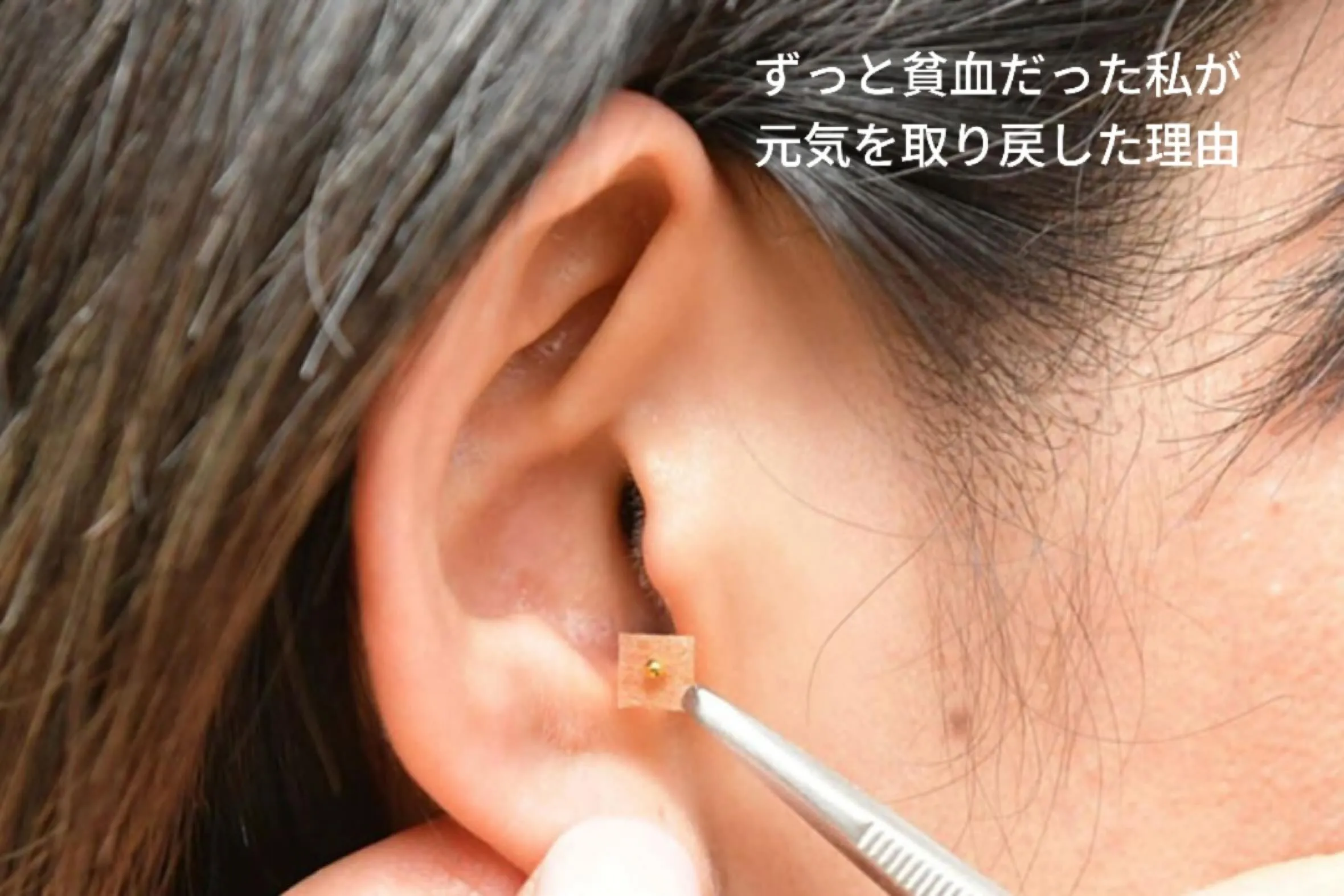 ずっと貧血だった私。