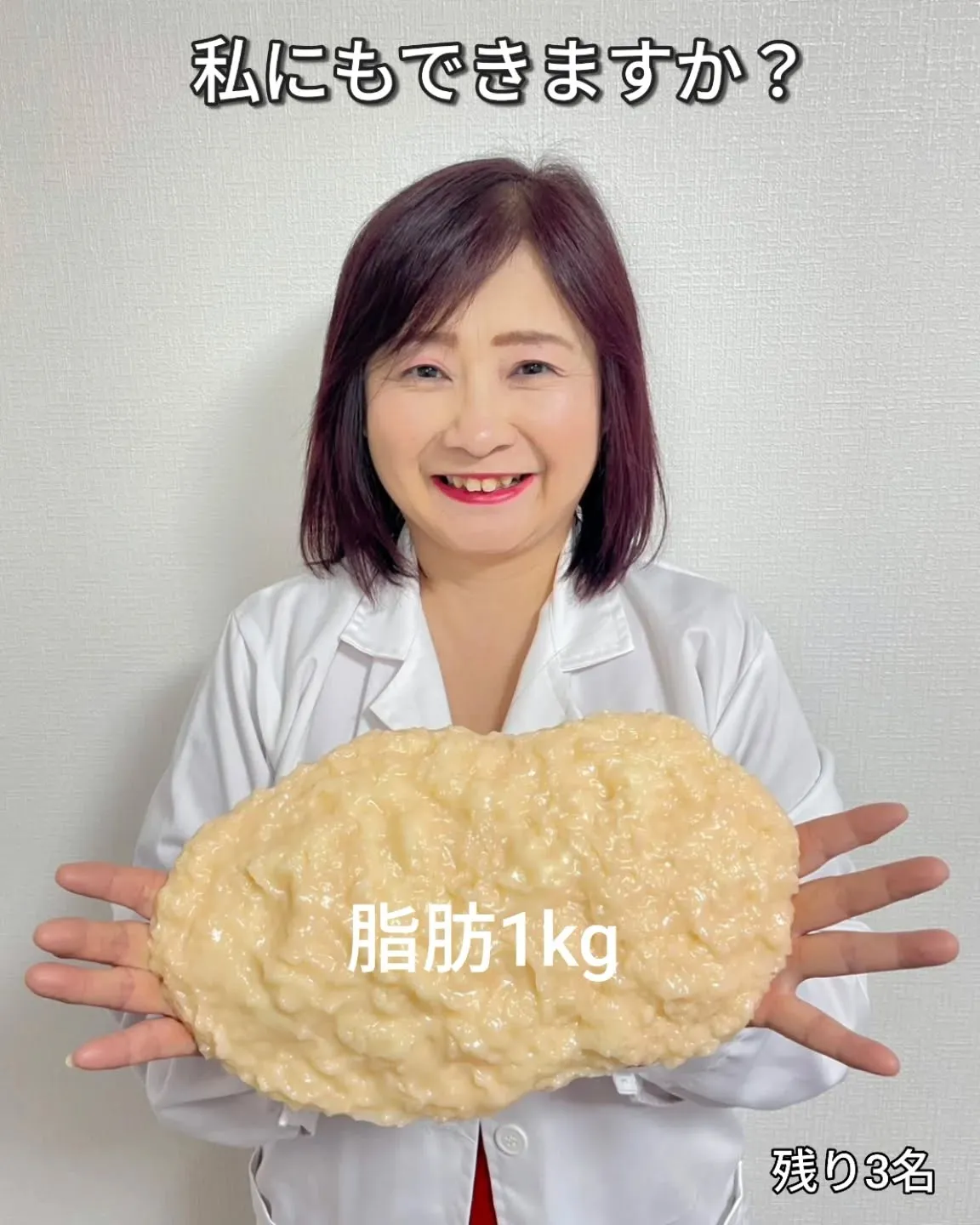 「私にもできますか？」