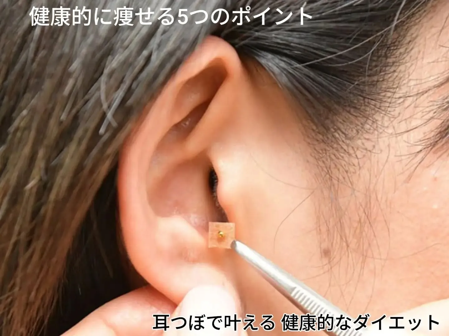 耳つぼで健康的に痩せる5つのポイント✨